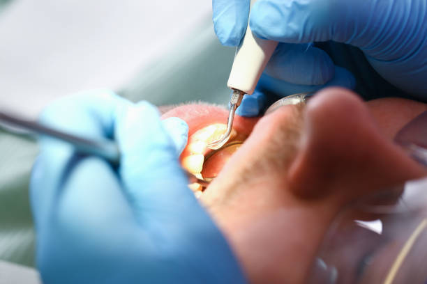 Best Urgent Care for Lost Fillings or Crowns in Strasburg, OH
