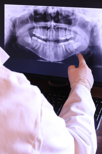 Best Emergency Tooth Extraction in Strasburg, OH